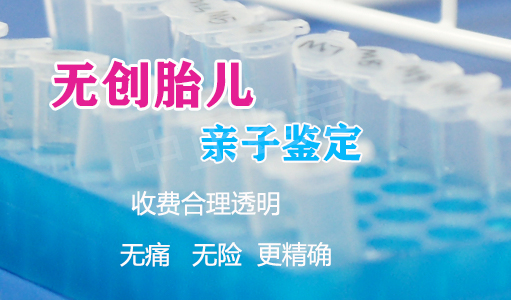 刚怀孕如何鉴定宝宝是谁的[河南],河南无创孕期亲子鉴定多少钱